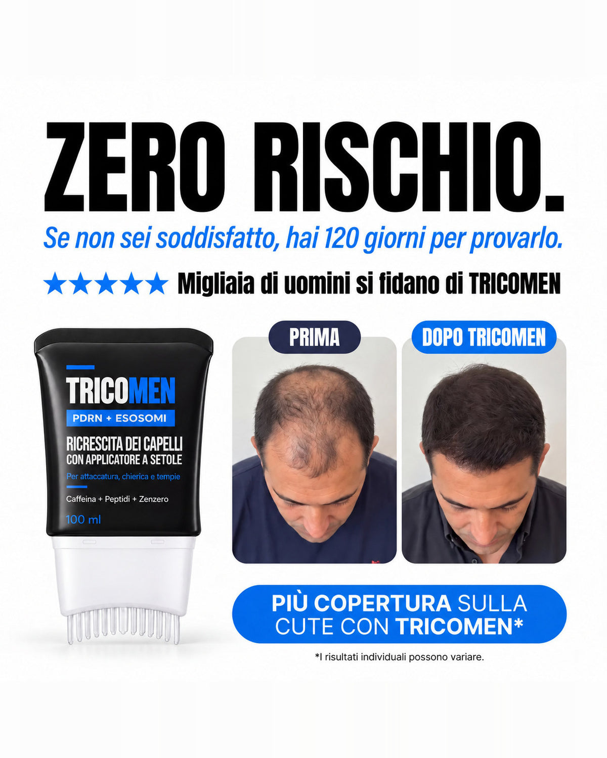 TRICOMEN – Siero Ricrescita Capelli con Applicatore a Setole